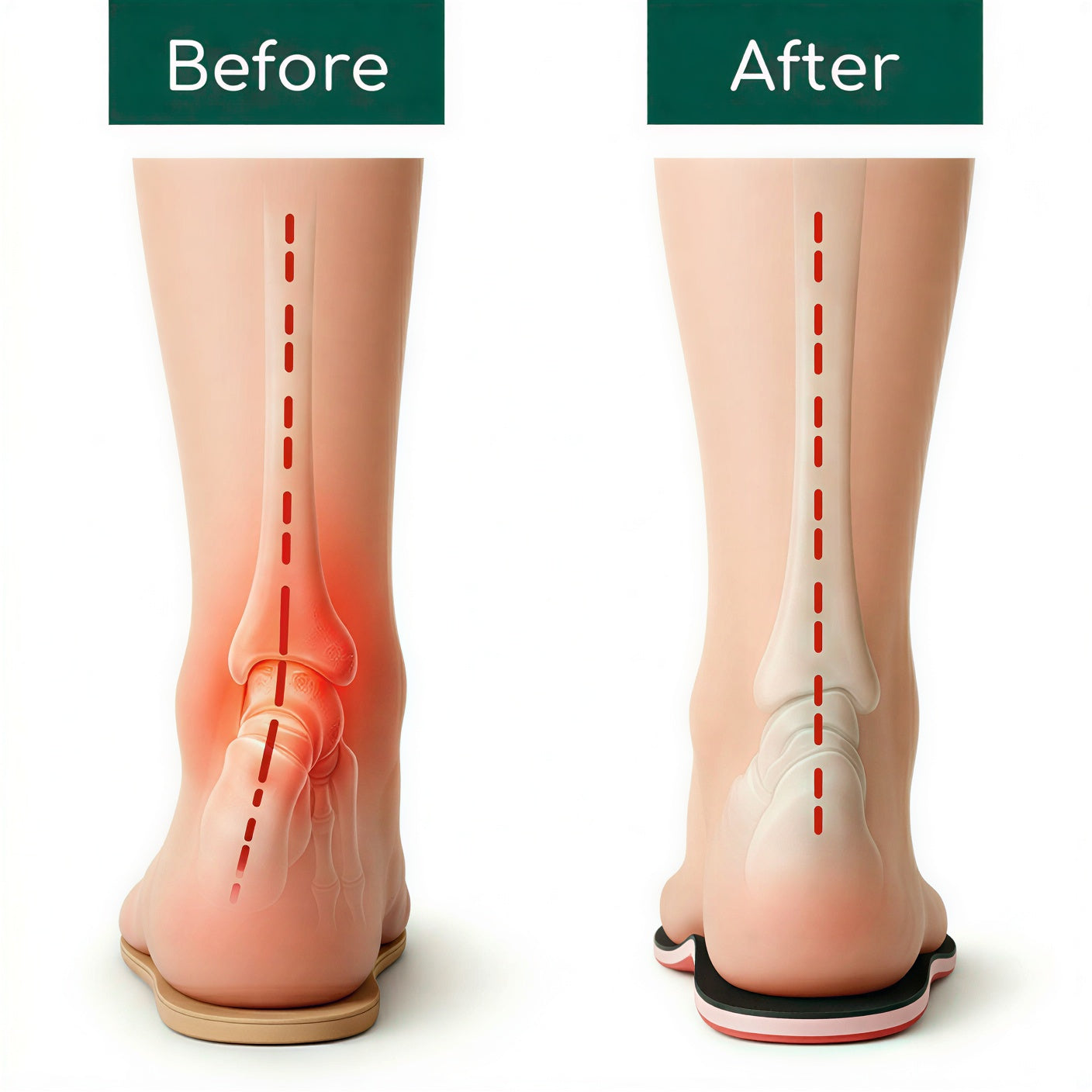 Axisoles: Insoles for Optimal Support and Stability
